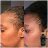 GREAUX Healthy Hair Drops